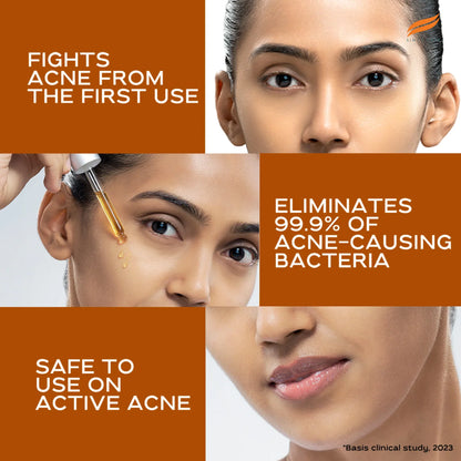 Acne Clear+ Scar Removal Serum